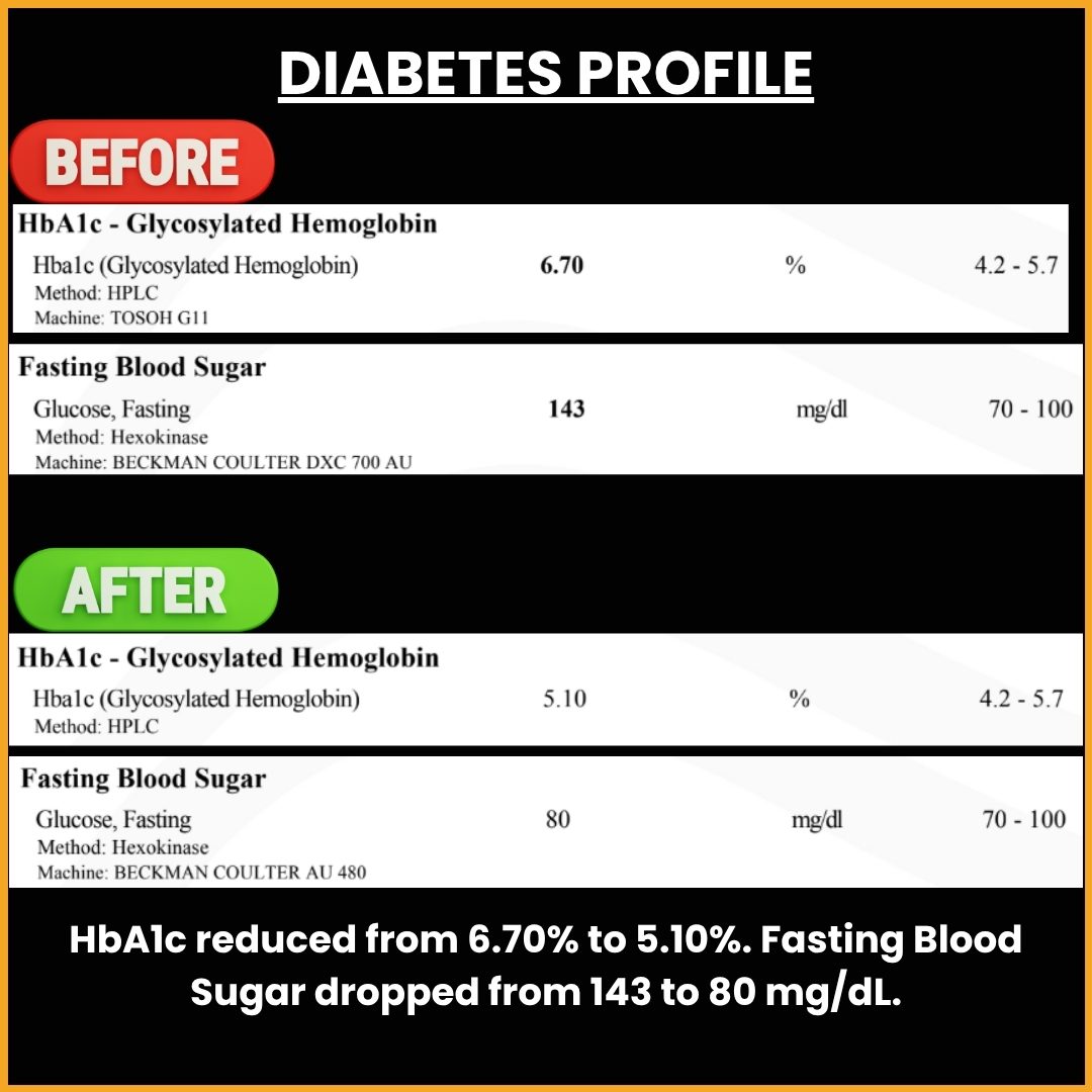 Diabetes Profile Transformation