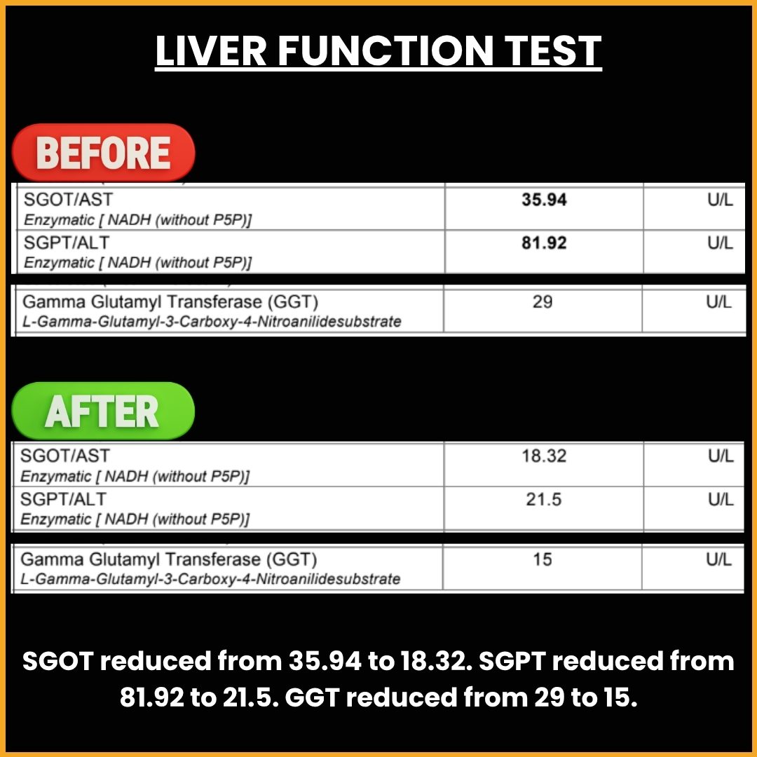 Liver Function Test Transformation